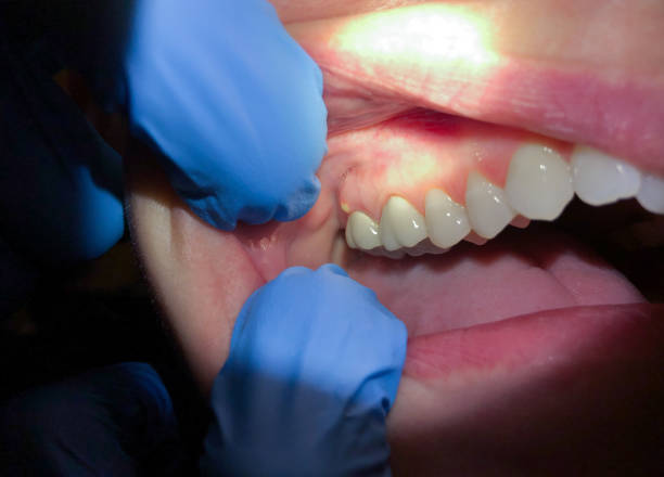 Best Urgent Care for Lost Fillings or Crowns in Cloverleaf, TX