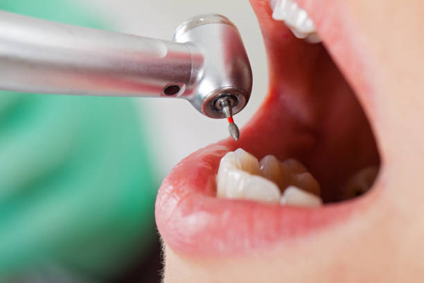 Best Emergency Denture Repair in Cloverleaf, TX